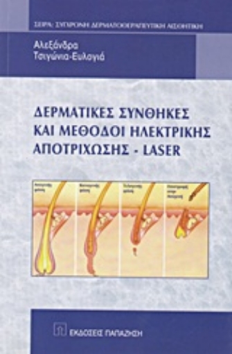 Εικόνα της Δερματικές συνθήκες και μέθοδοι ηλεκτρικής αποτρίχωσης - Laser