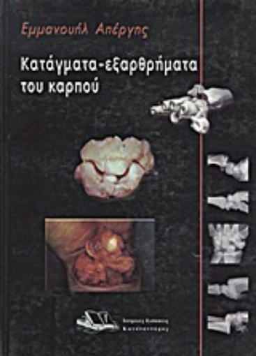 Εικόνα της Κατάγματα - εξαρθρήματα του καρπού