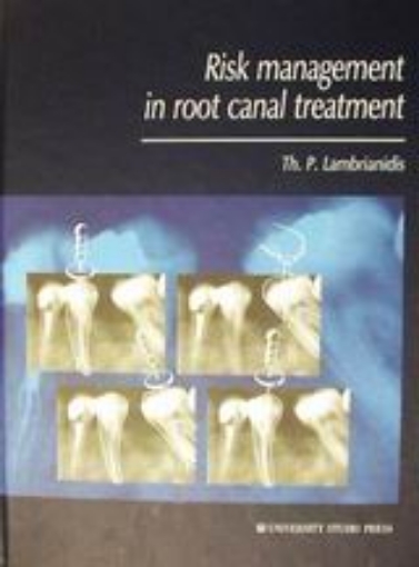 Εικόνα της Risk Management in Root Canal Treatment