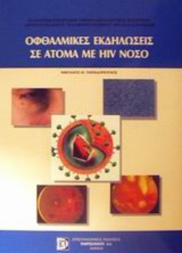 Εικόνα της Οφθαλμικές εκδηλώσεις σε άτομα με HIV νόσο