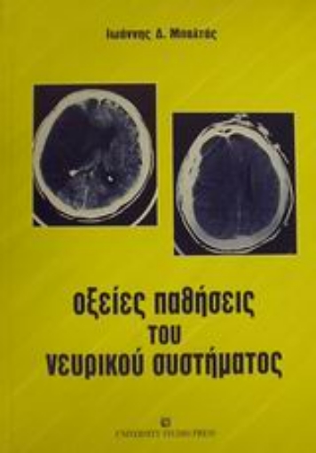 Εικόνα της Οξείες παθήσεις του νευρικού συστήματος