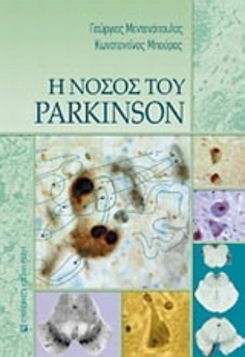 Εικόνα της Η νόσος του Parkinson