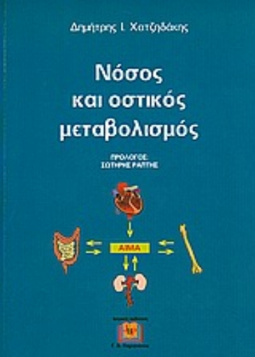 Εικόνα της Νόσος και οστικός μεταβολισμός