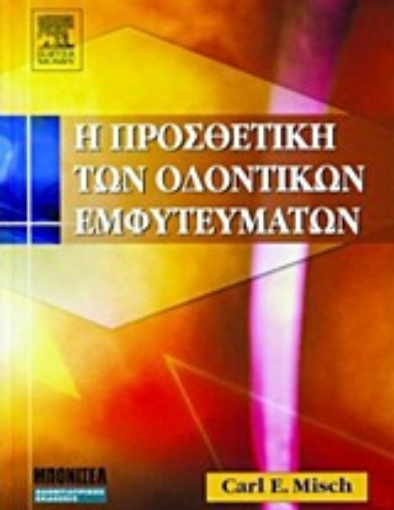 Εικόνα της Η προσθετική των οδοντικών εμφυτευμάτων