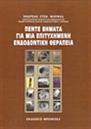 Εικόνα της Πέντε βήματα για μια επιτυχημένη ενδοδοντική θεραπεία