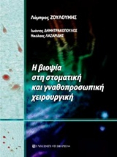 Εικόνα της Η βιοψία στη στοματική και γναθοπροσωπική χειρουργική