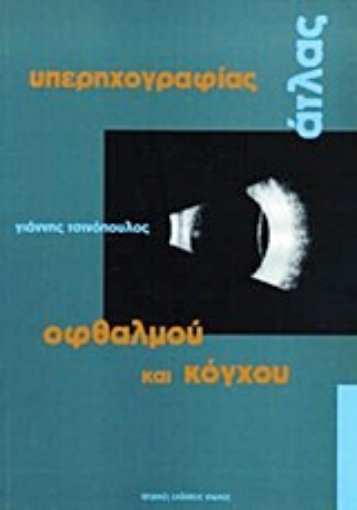 Εικόνα της Άτλας υπερηχογραφίας οφθαλμού και κόγχου