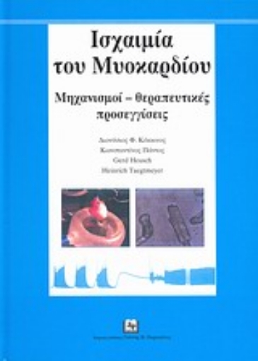 Εικόνα της Ισχαιμία του μυοκαρδίου