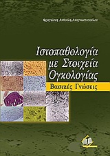 Εικόνα της Ιστοπαθολογία με στοιχεία ογκολογίας