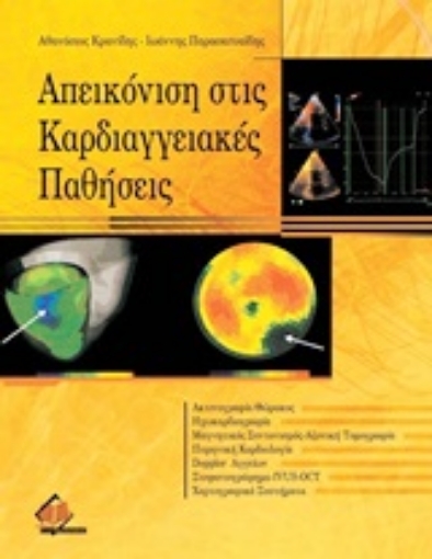 Εικόνα της Απεικόνιση στις καρδιαγγειακές παθήσεις