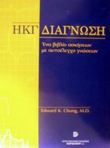 Εικόνα της Διάγνωση ηλεκτροκαρδιογραφήματος