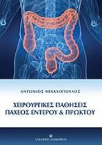 205572-Χειρουργικές παθήσεις παχέος εντέρου και πρωκτού