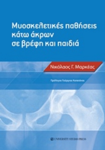 234927-Μυοσκελετικές παθήσεις κάτω άκρων σε βρέφη και παιδιά