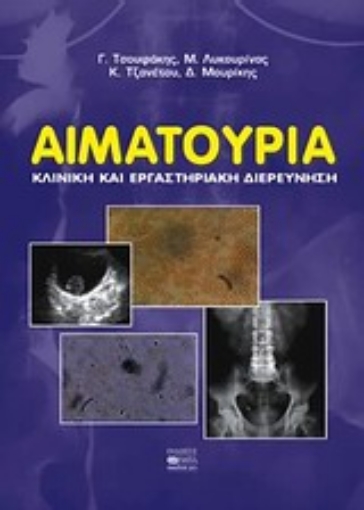 55184-Αιματοουρία