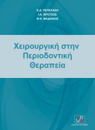 279392-Χειρουργική στην περιοδοντική θεραπεία